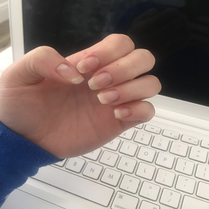 After image showing significantly longer/healthier looking nails