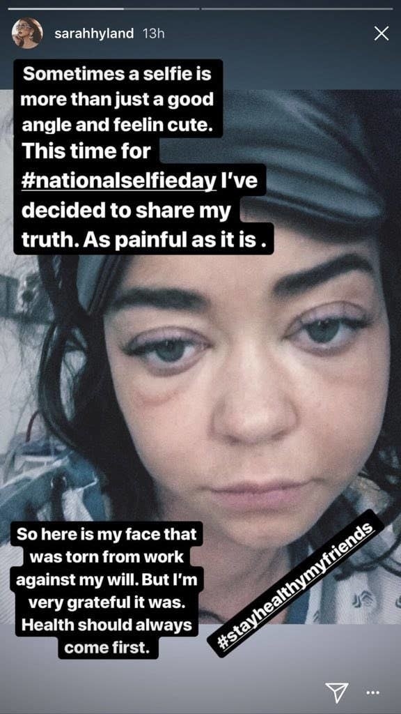 A screenshot from Sarah&#x27;s Instagram story showing her puffy face and the &quot;painful truth&quot; she&#x27;s sharing for National Selfie Day: &quot;So here is my face that was torn from work against my will, but I&#x27;m very grateful it was; health should always come first&quot;