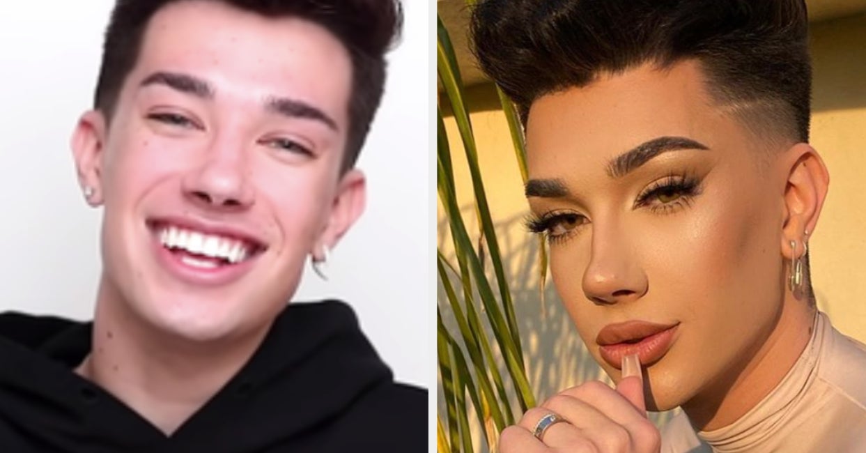 James Charles Revealed How Much Work He's Had Done