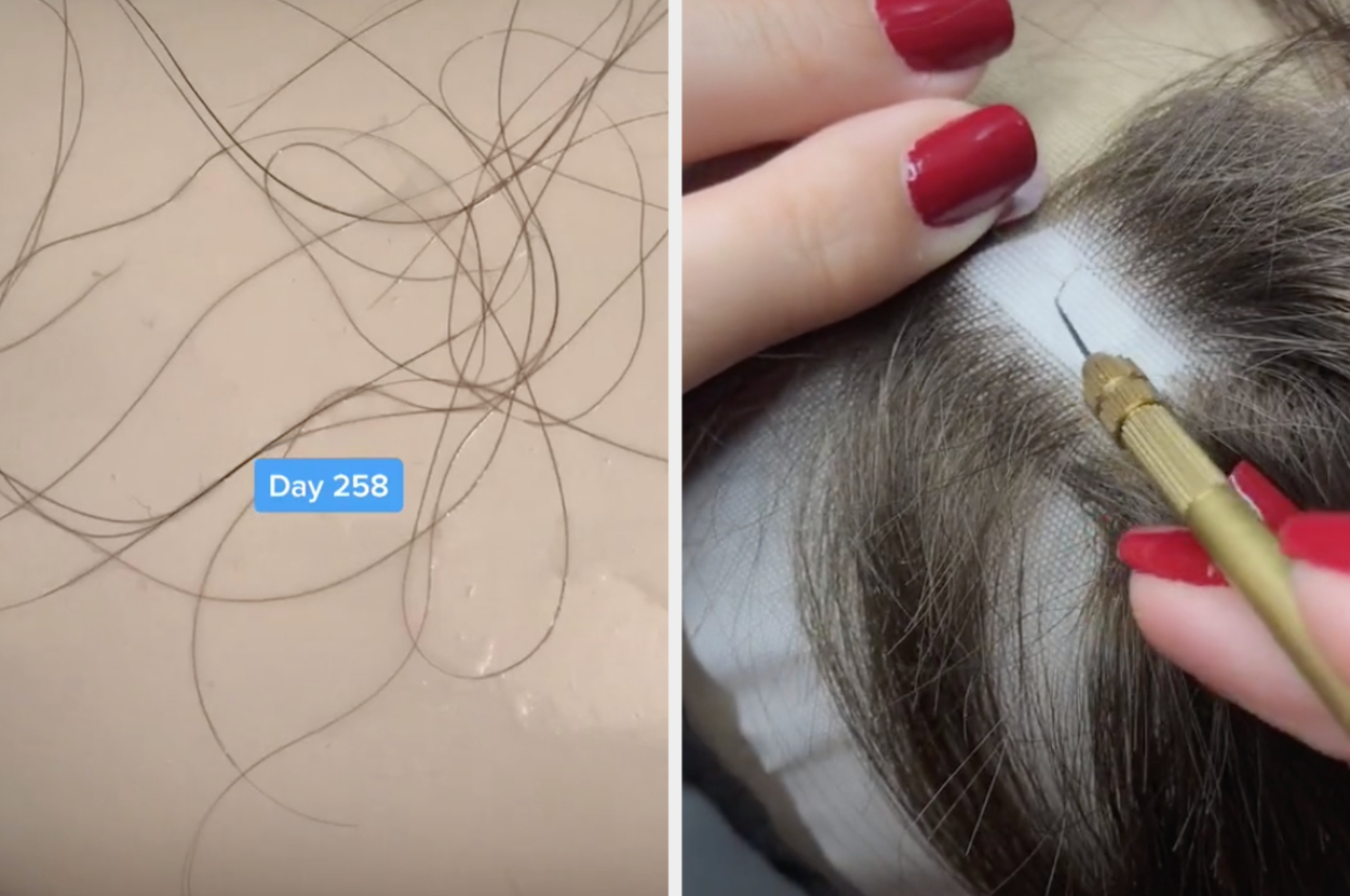 I became a wigmaker after my hair fell out