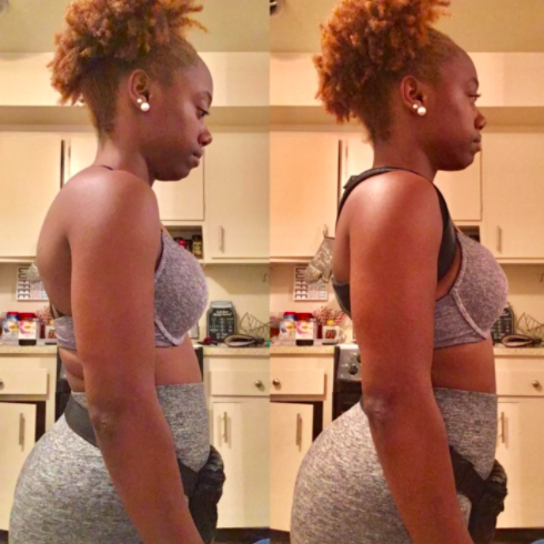 a before and after showing the brace making their shoulders pull back upright