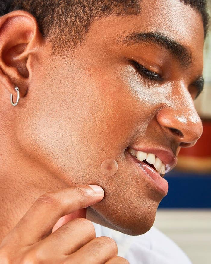 Person wearing pimple patch on his upper chin 