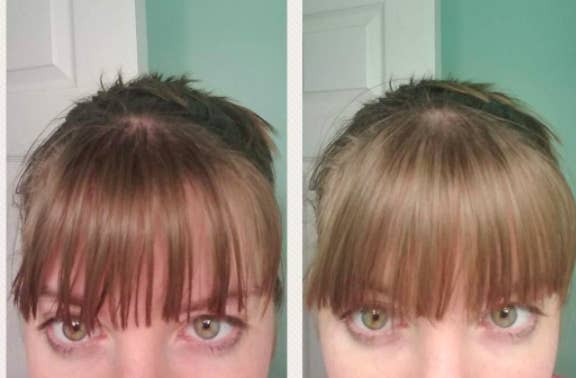 reviewer before-and-after showing their bangs noticeably less greasy after using dry shampoo 