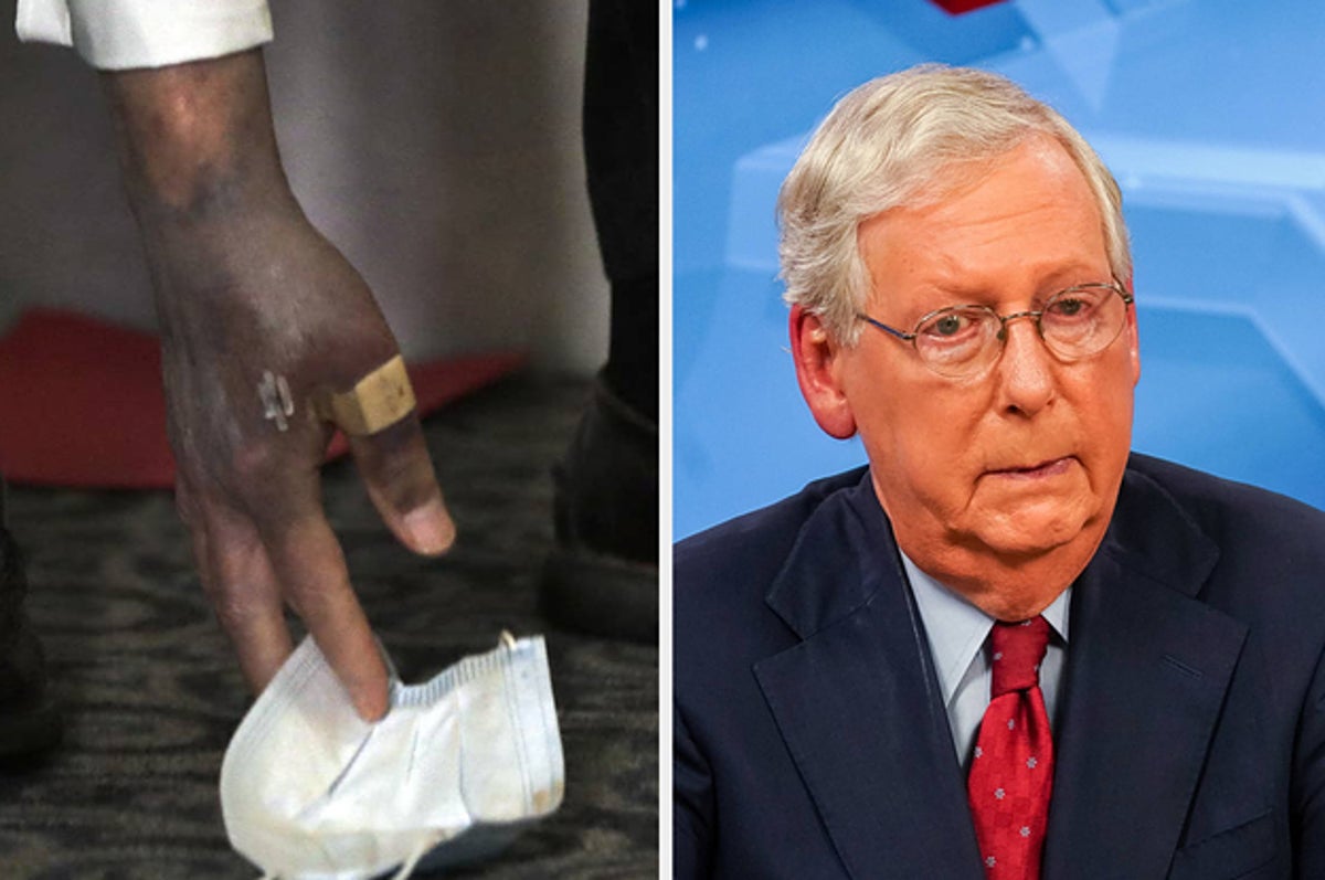 What’s With Mitch McConnell’s Hands? Mitch-mcconnells-hand-is-discolored-but-he-swears-2-522-1603402549-64_dblbig