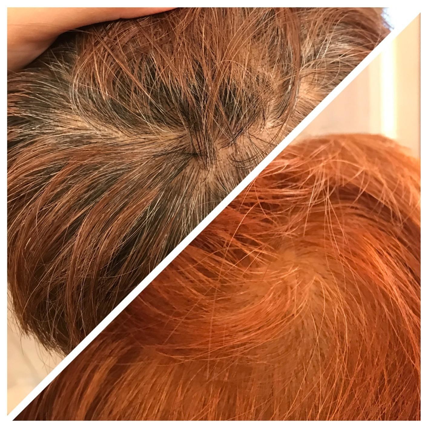 A reviewer&#x27;s before and after pics where in the before their hair is dark brown and in the after it is vibrant copper