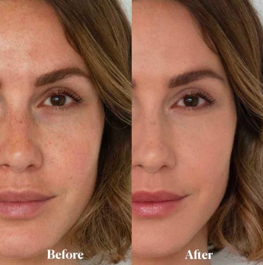 A before and after with someone with and then smooth skin