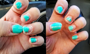 Reviewer before and after with dry, cracked nail beds smooth after use 
