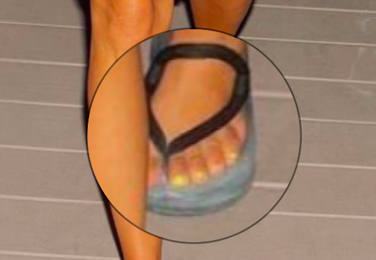 Closeup of Kim&#x27;s toes