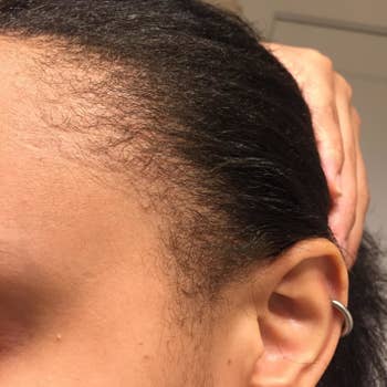 reviewer's before of her natural edges and baby hairs 