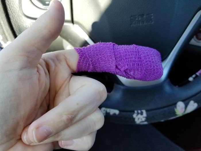 A bandaged pointer finger wrapped in purple gauze 