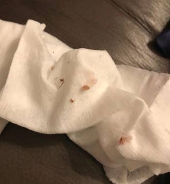 Pieces of crust and mucus from using the pet tearstain comb
