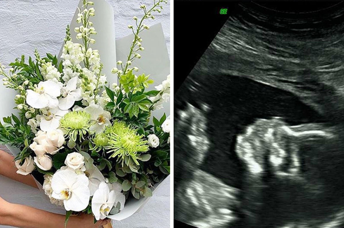 e learning for kindergarten What Color Flowers For Miscarriage The