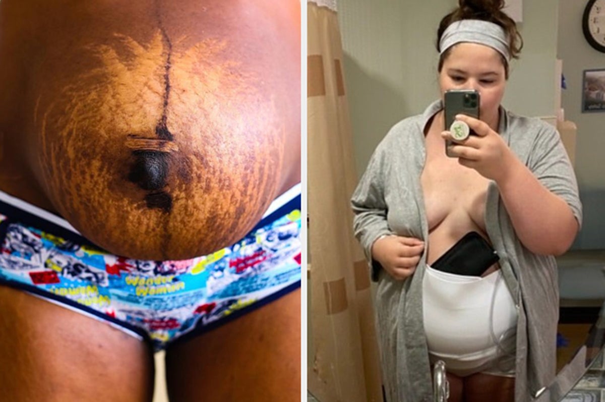 These Are the 'Real' Postpartum Body Photos Every Mom Needs to See