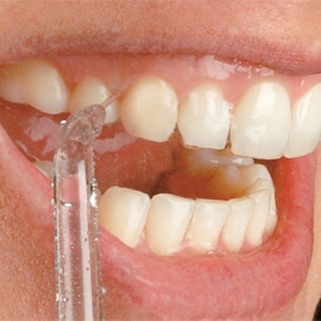 A close up of the water flosser in action as it cleans between a person&#x27;s gums