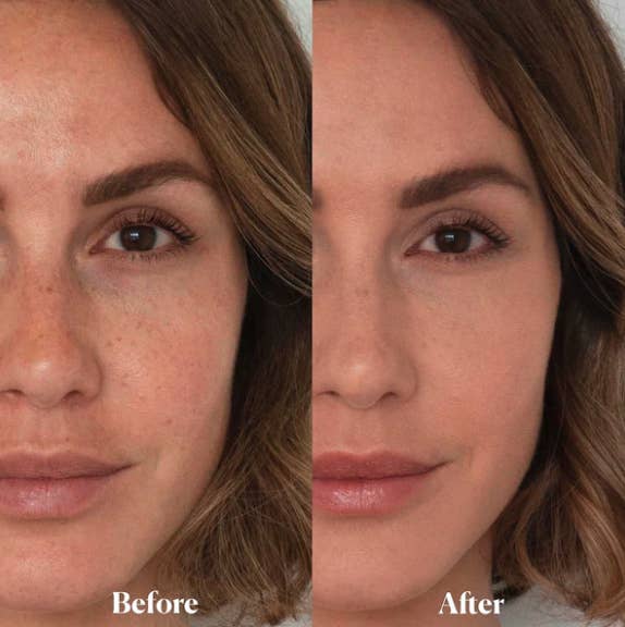 A before and after photo showing the setting powder creating a smoother complexion
