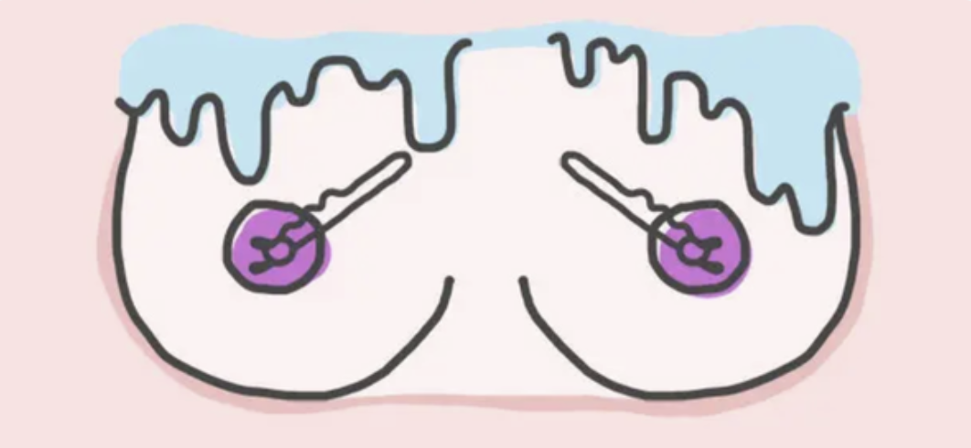 An illustration of someone&#x27;s breasts with bobby pins on the nipples