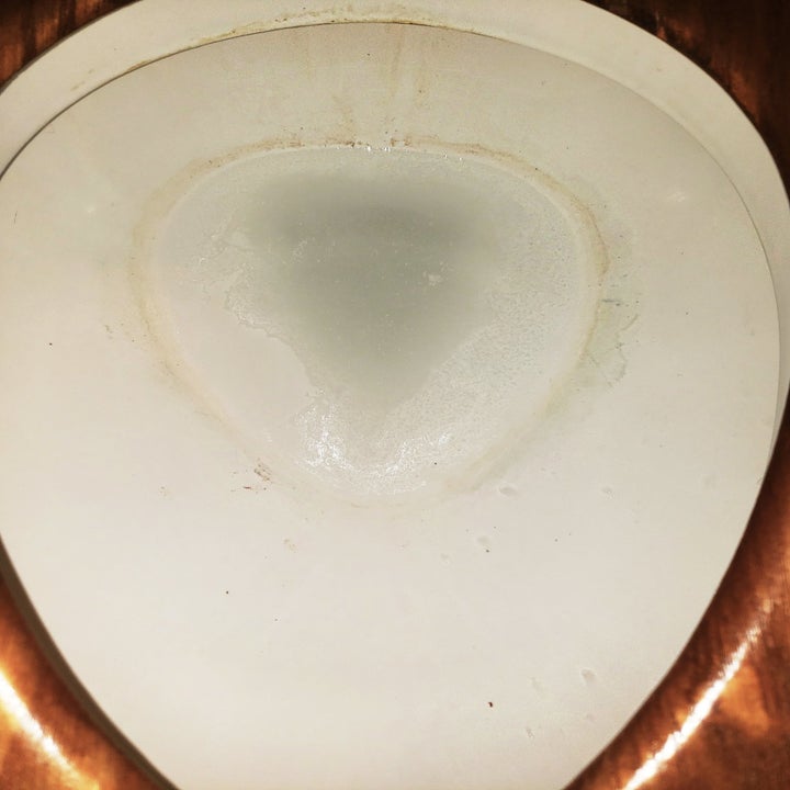 a dirty toilet 