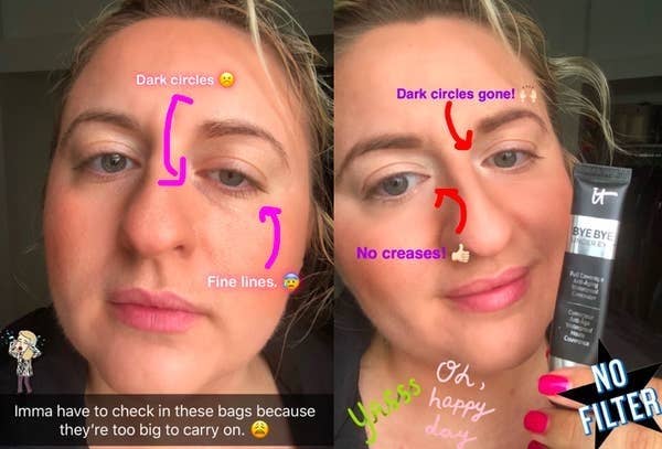 A before image showing a BuzzFeed writer with darker circles and fine lines, and an after image of them holding the concealer tube and showing that the dark circles and fine lines are gone  