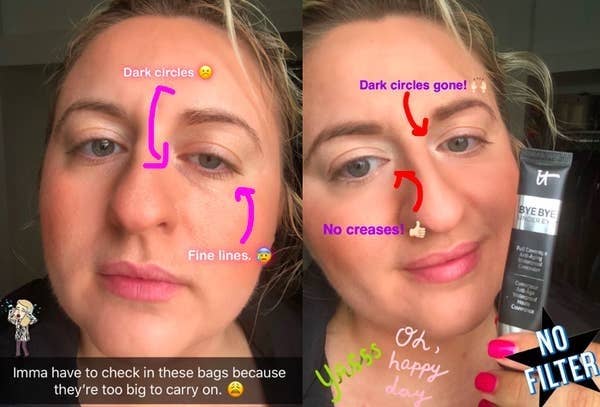A before image showing a BuzzFeed writer with darker circles and fine lines, and an after image of them holding the concealer tube and showing that the dark circles and fine lines are gone