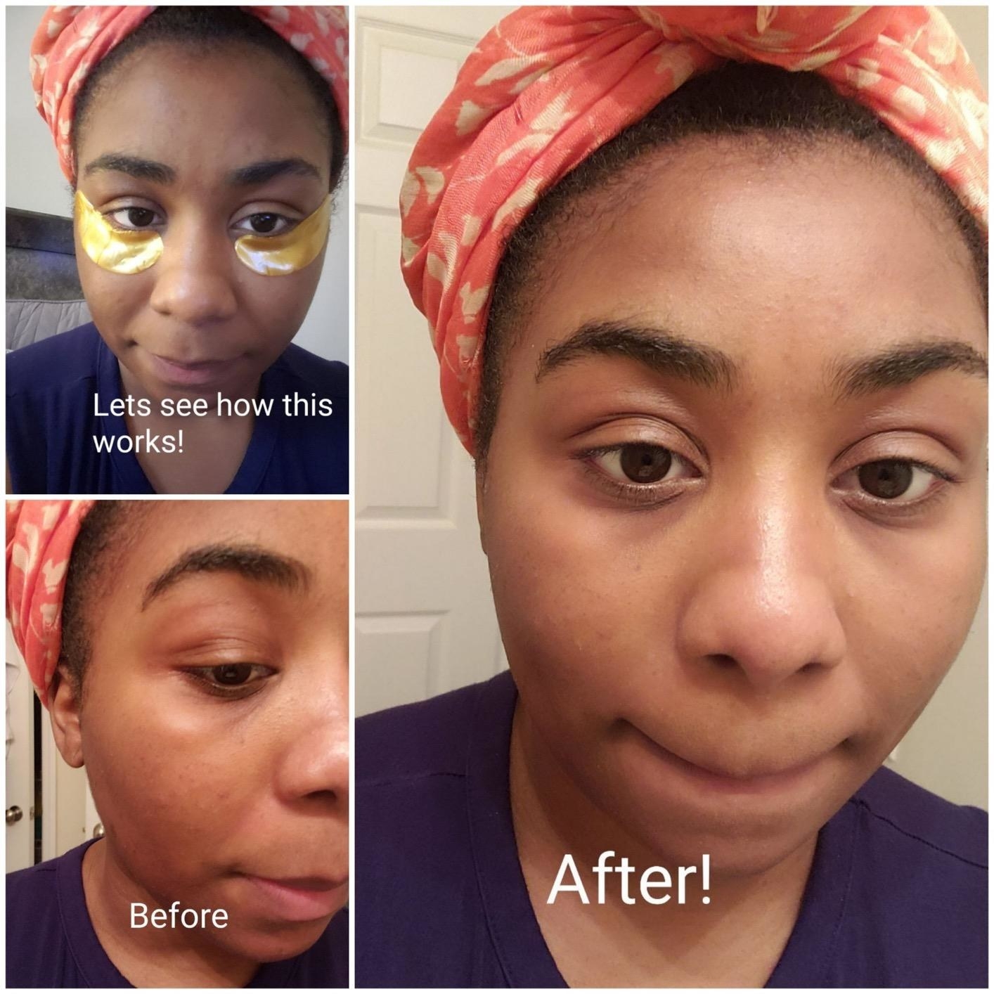 Reviewer wearing the eye patches, as well as their before and after photos showing the masks brightened the under-eye area