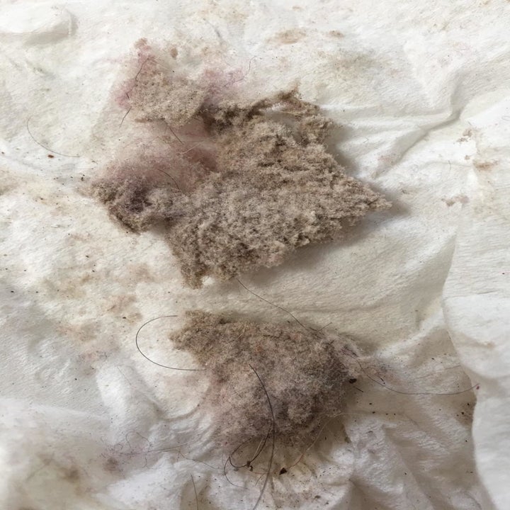 Reviewer image of dust mites to come out of cleaner