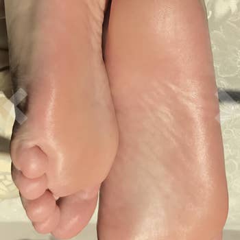 Reviewer moisturized feet after peeling