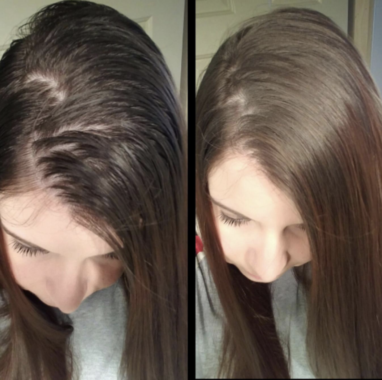 Reviewer before and after photo of dry shampoo results