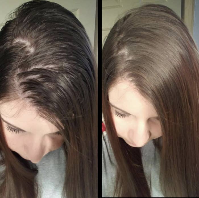 Reviewer before and after photo of dry shampoo results