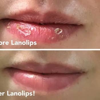 Reviewer photo of before and after lips using Lanolips