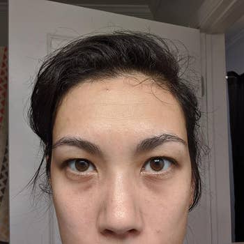 Reviewer with dark under-eye bags