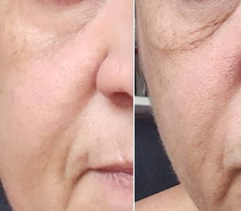 Reviewer before and after showing the cream tightened and brightened their under-eye area