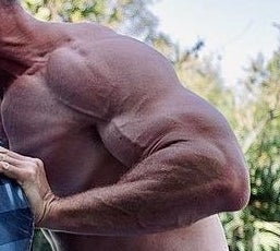A closeup of Chris's arms