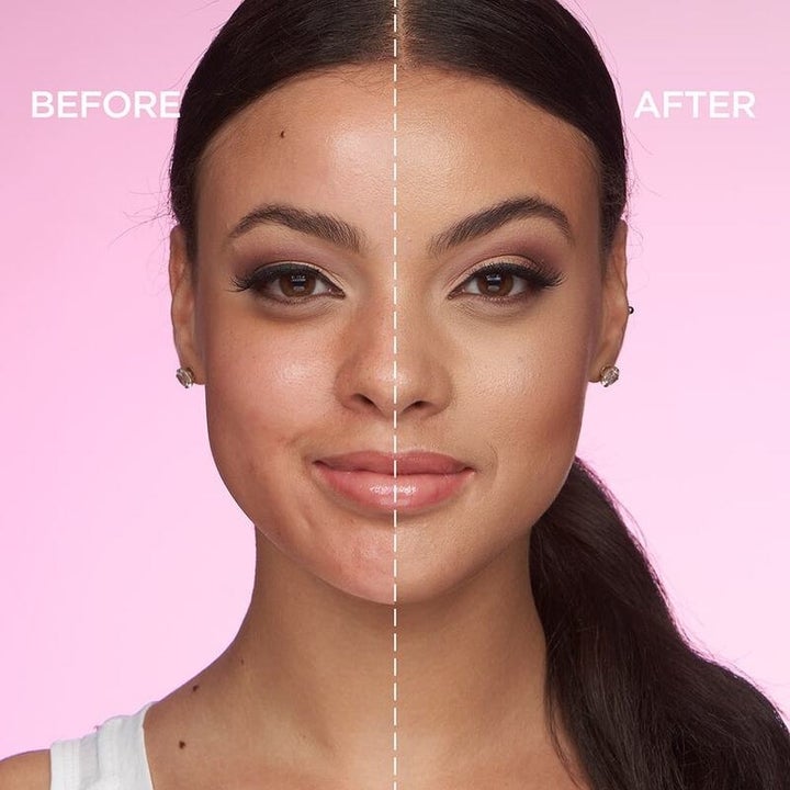 Model's before and after showing the concealer masked the appearance of redness