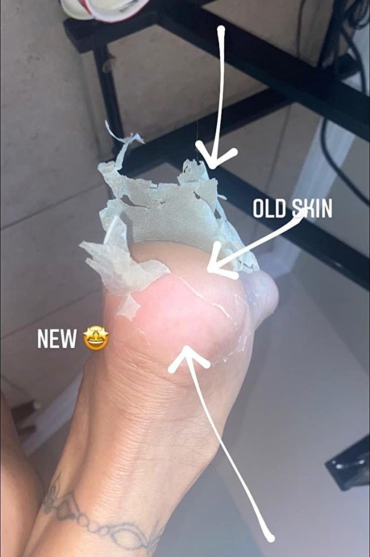 A reviewer&#x27;s feet mid-peel
