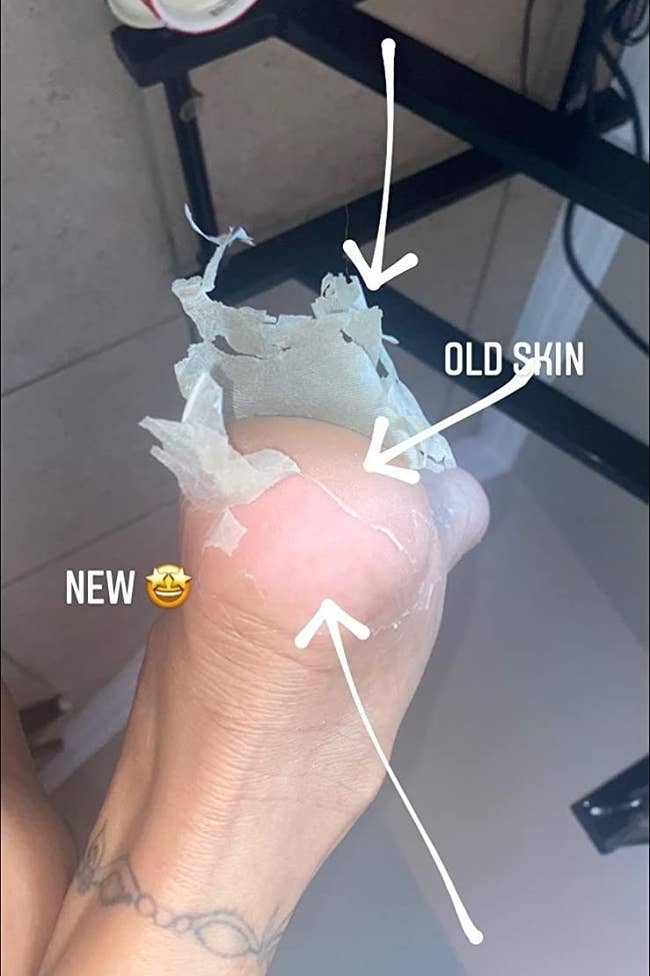 A reviewer's feet mid-peel