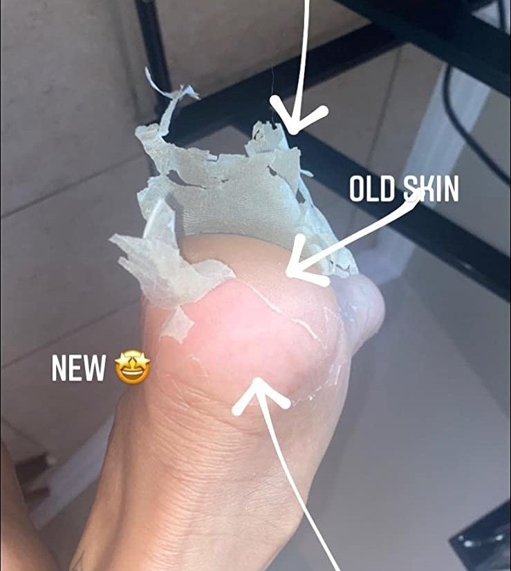 A reviewer&#x27;s feet mid-peel