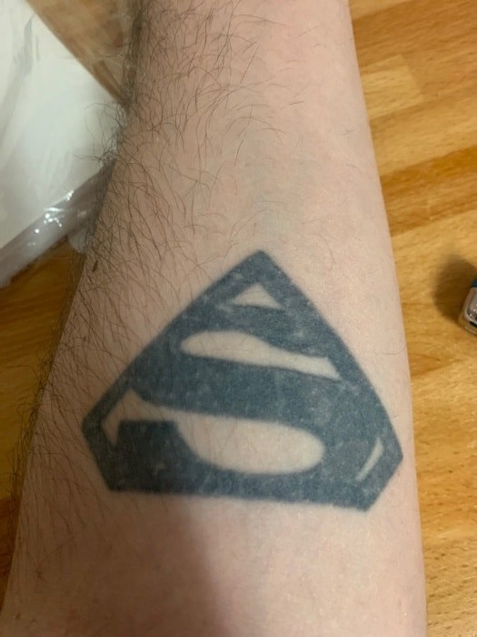 A faded black Superman symbol tattoo on someone&#x27;s arm