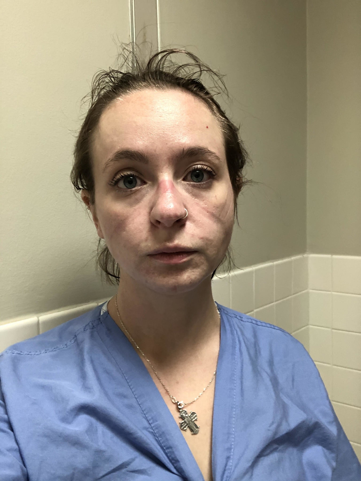 Kathryn looking at the camera in rumpled scrubs with large bags under her eyes, grooves in her face from wearing PPE, and sweaty hair sticking straight up from her head.