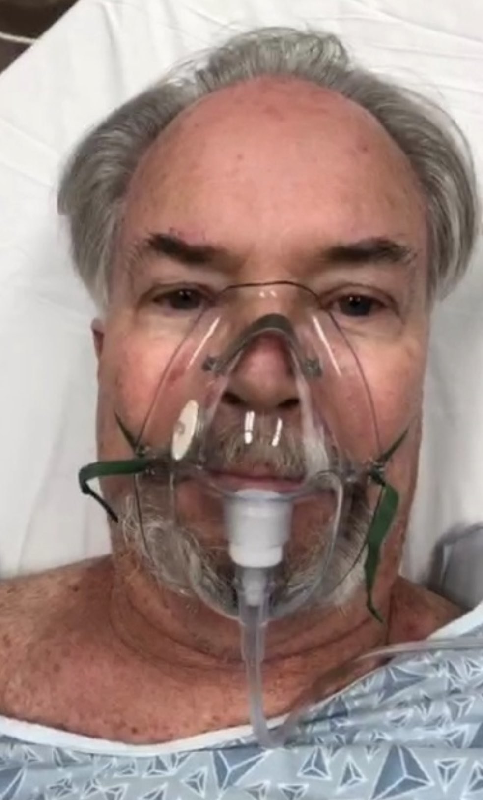 Steve Austin in the ICU wearing an oxygen mask