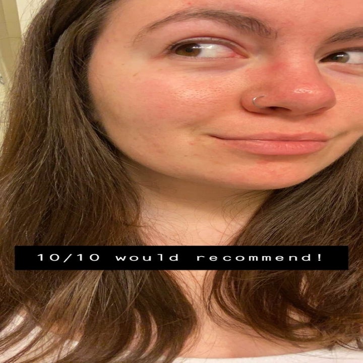 Same reviewer's face with no makeup after using the reusable makeup remover pads
