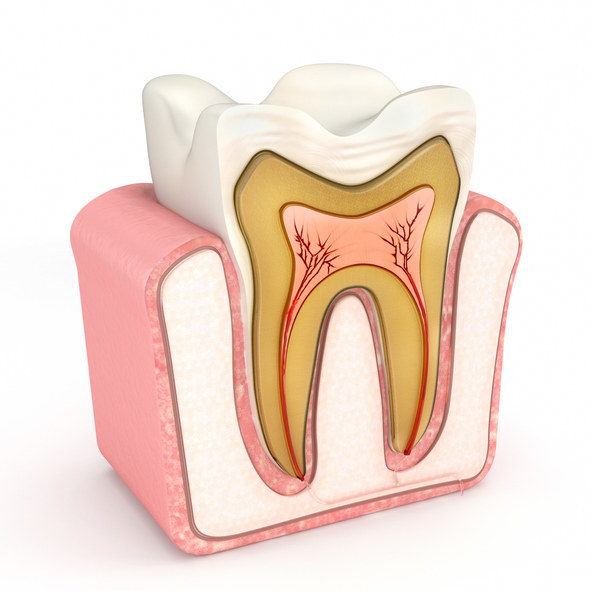 Image of the inside of the tooth with its nerves.