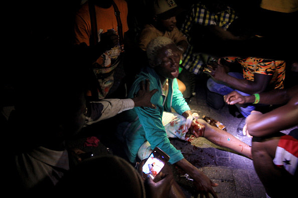People surround a man who is bleeding from his leg