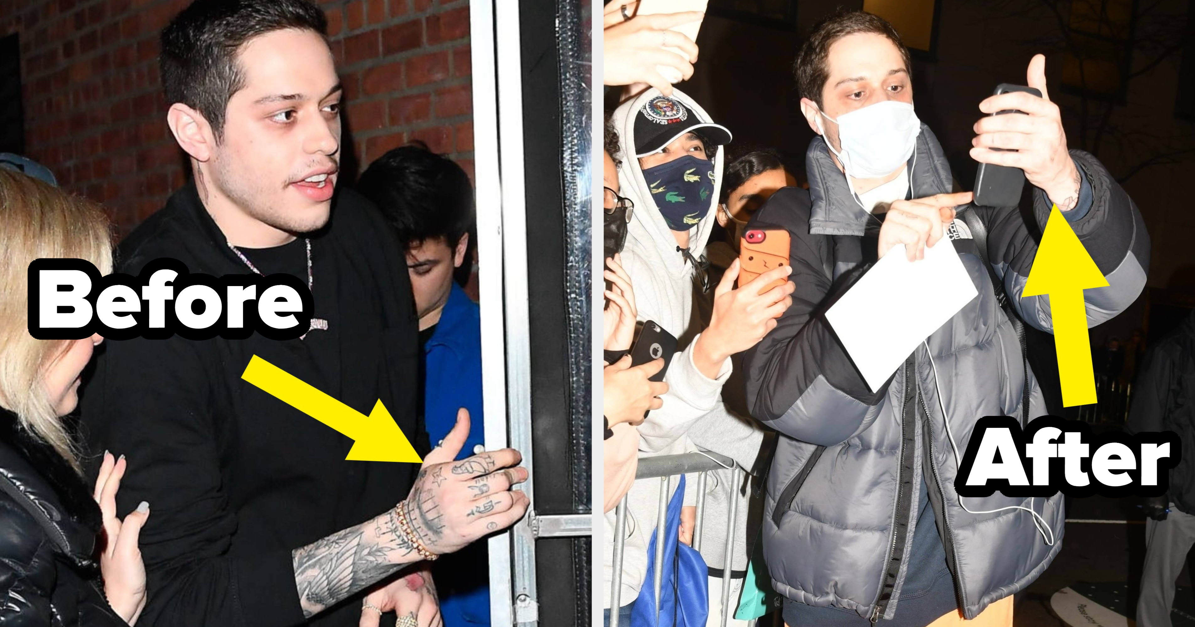 Pete Davidson Reportedly Removing All Of His Tattoos