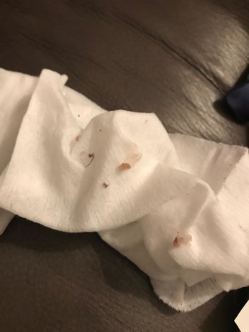A customer review photo of their dog's eye gunk on a paper towel after using the tear stain comb