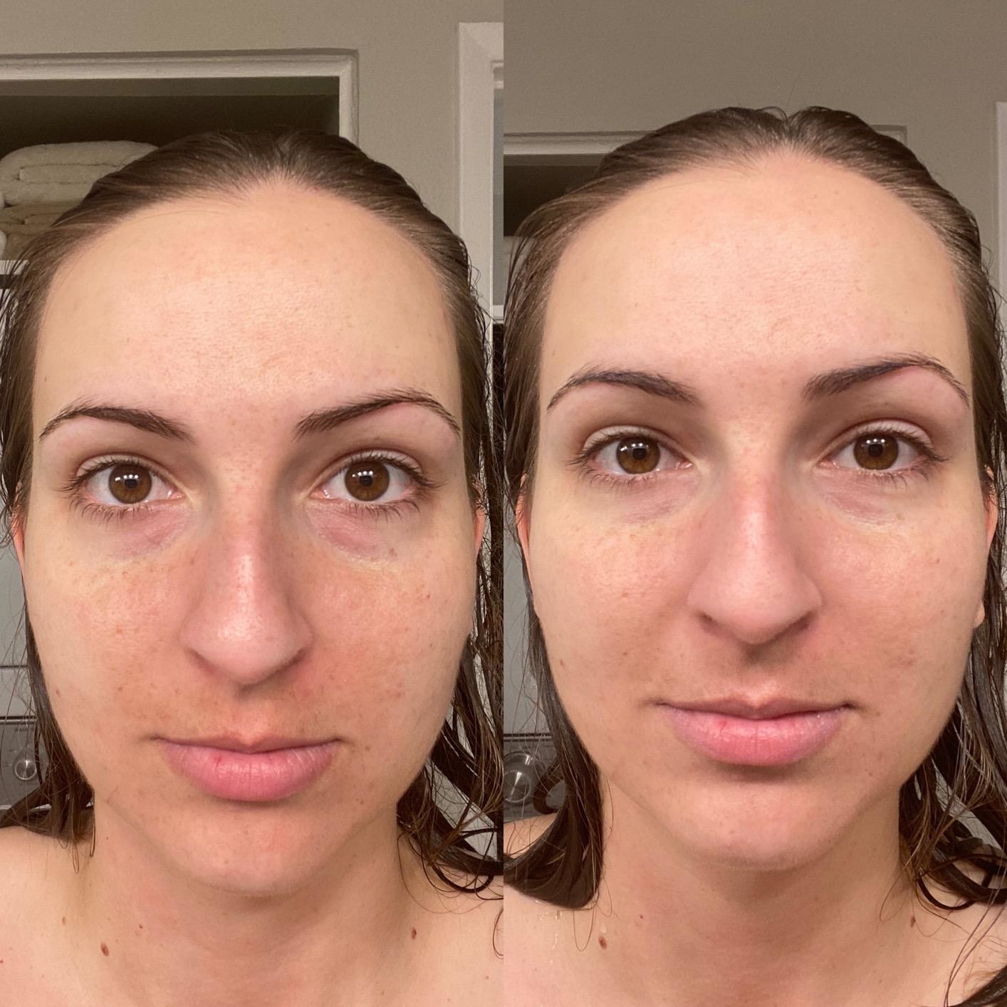 Before and after of reviewer wearing the sunscreen showing that it doesn't look greasy and that it provides a subtle tint
