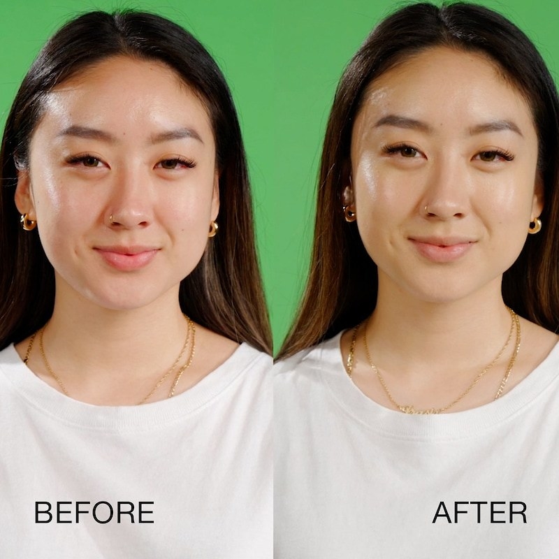 Before and after of model showing the treatment neutralized basically all the redness on their face