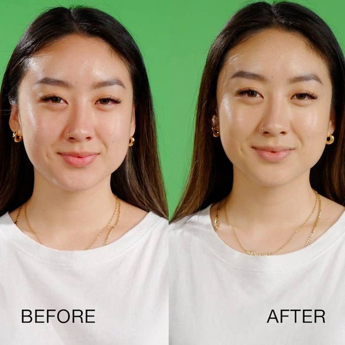 Before and after of model showing the treatment neutralized basically all the redness on their face