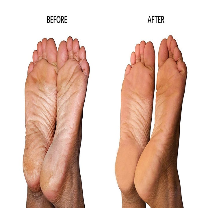 Before and after image.