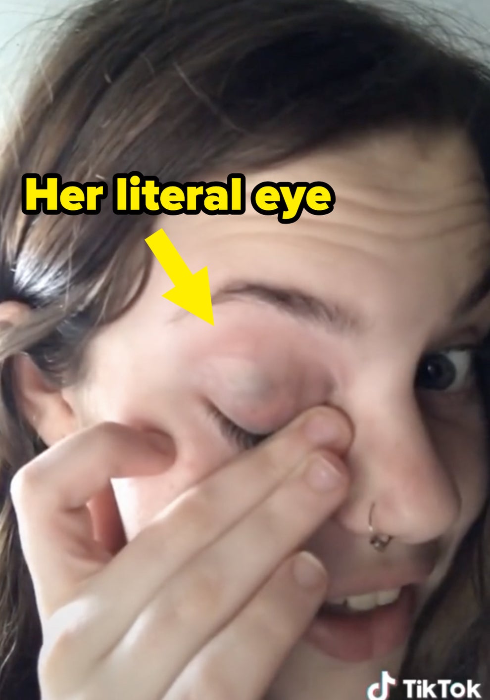 what is a monocle for eye｜TikTok Search