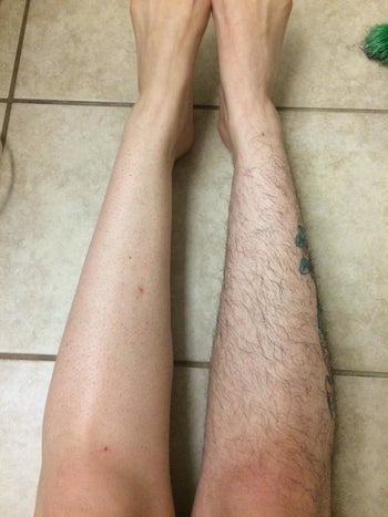 Reviewer comparing their smooth epilated legs to their fuzzy non-epilated leg